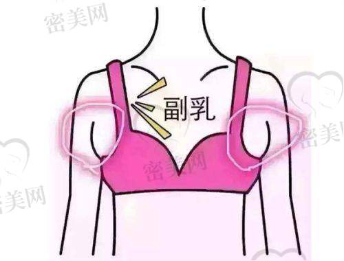 陈松医生口碑怎么样？