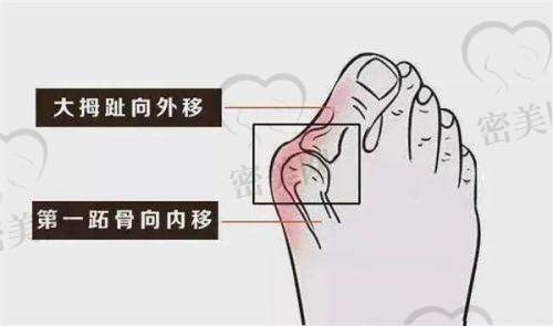北京嘉禾医疗美容：侯智慧院长的“脚脚拯救计划”