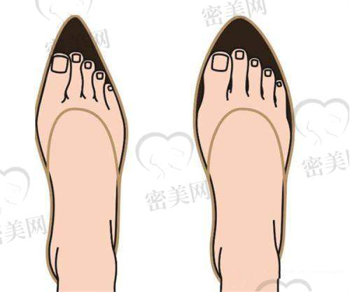 北京同仁医院：眼科“名咖”也有美足“神技”