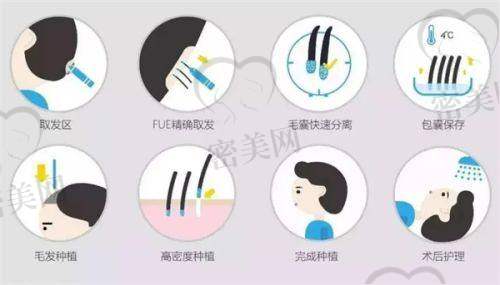 福州美莱植发中 心
