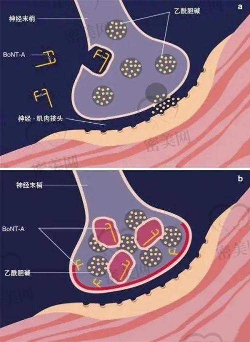 陈松医生擅长项目：