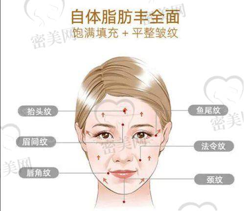 张宝生医生怎么预约挂号？