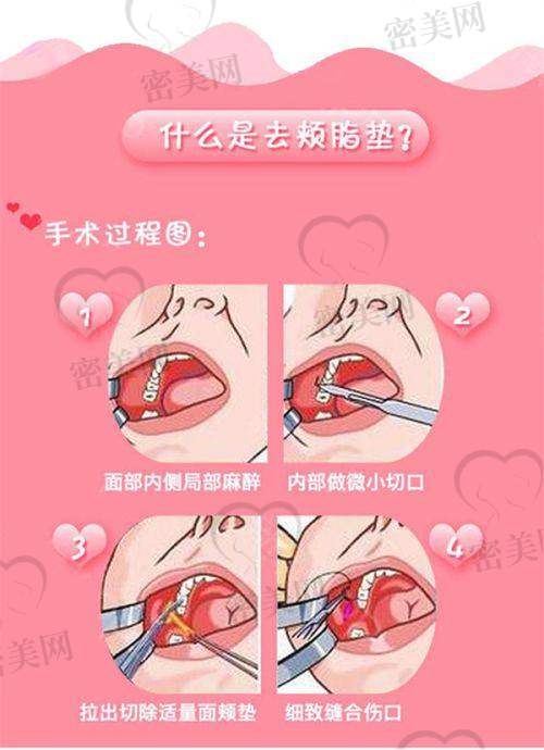 李良辰医生口碑怎么样？