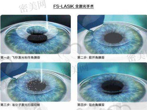 赣南医学校第一附属医院眼科——青光眼手术及其他常见项目价格