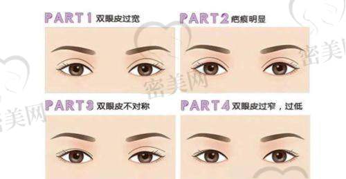 上海许炎龙成功实例让人惊艳