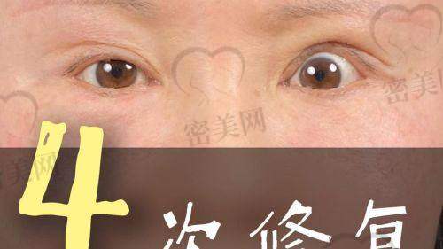 上海爱尚丽格王衡健眼部修复：口碑爆棚超厉害