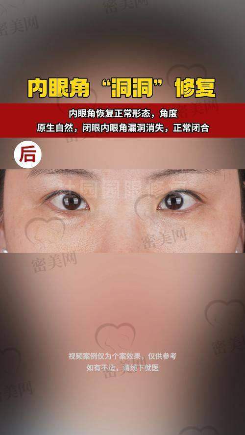北京晶美医疗美容：实力雄厚的整形殿堂