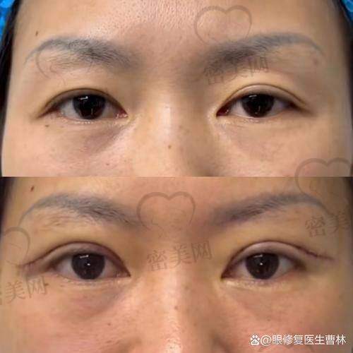 北京晶美医疗美容魏志香：口碑爆棚的秘密武器