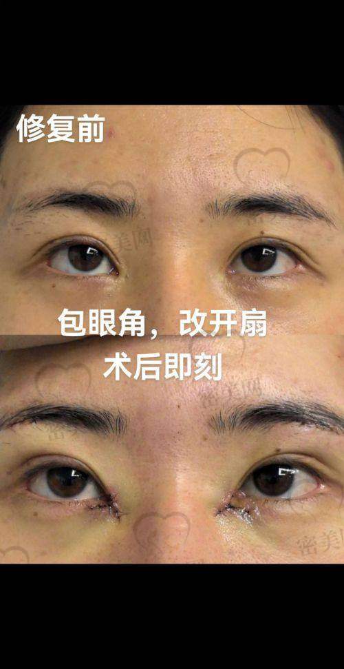 上海爱尚丽格张诗若眼部修复：技术优势全解析