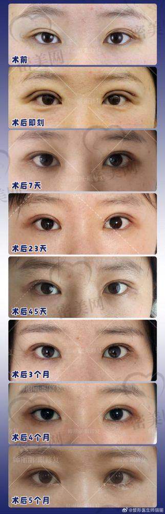 上海爱尚丽格王衡健眼部修复：技术优势大揭秘