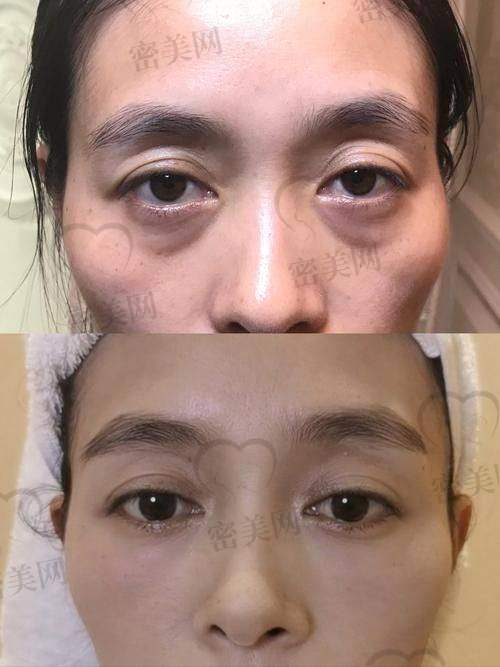 魏志香医生的神奇技术：成效立竿见影