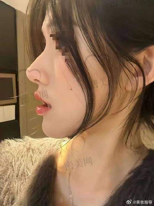 瞿健医生适合哪些类型的求美者？
