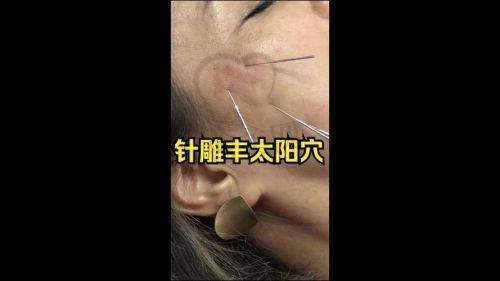 重庆联合丽格医疗美容医院：干细胞脂肪技术，存活率爆表