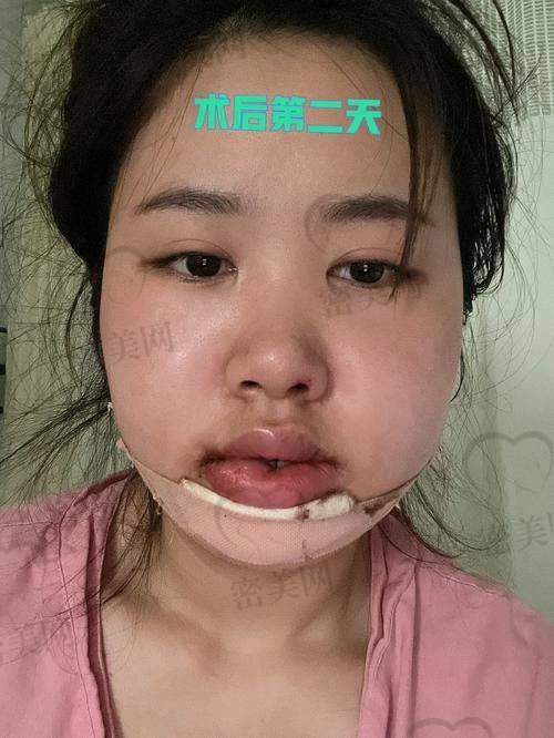 上海时光何晋龙正颌手术：实力医生大揭秘