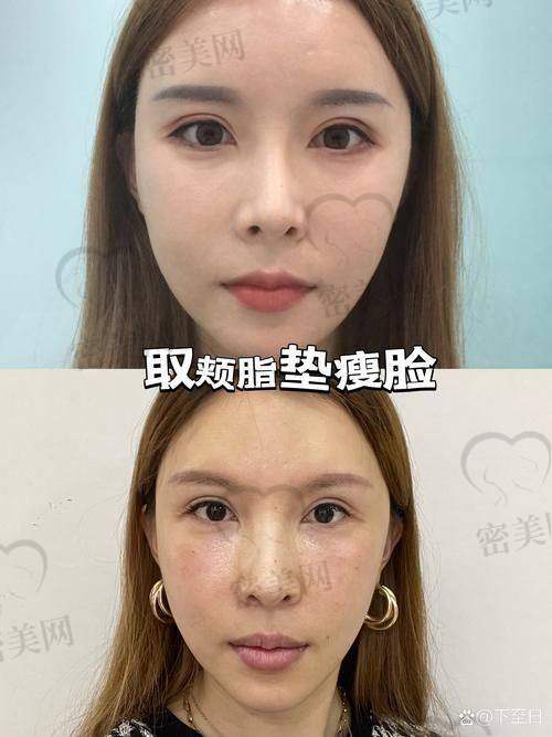 上海伯思立整形顾建成：口碑爆棚的变得更美魔法师