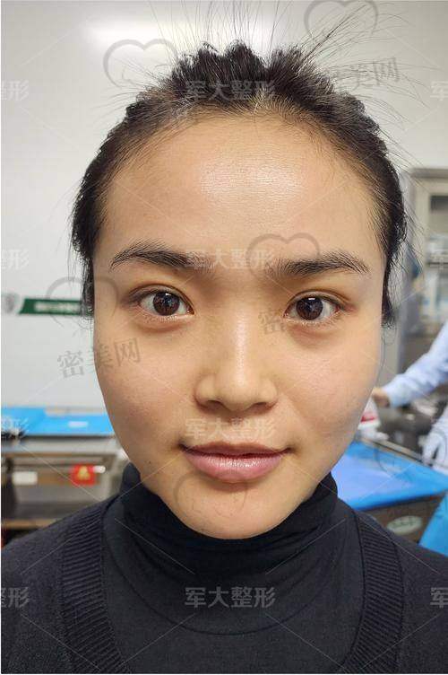 注射前后注意事项