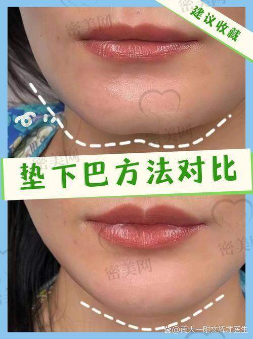 选择医院要慎重！