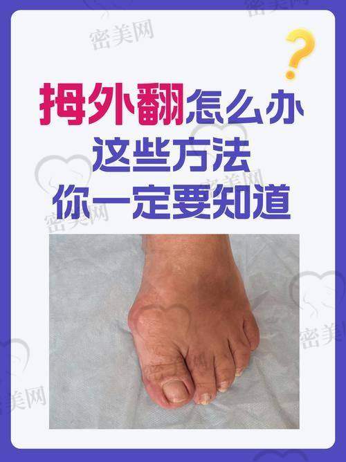 北京加减美医疗美容：穆宝安院长的“美足魔法秀”