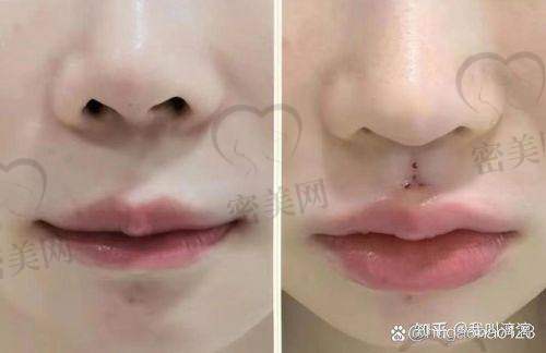 胡俊杰医生为何成为深圳人中缩短优选医生？