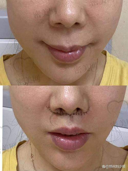术后护理Tips：修复快就是这么做出来的