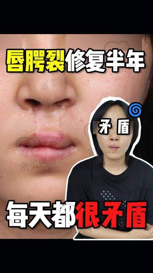 重庆当代整形医院——术前模拟+术后还原度高达90%