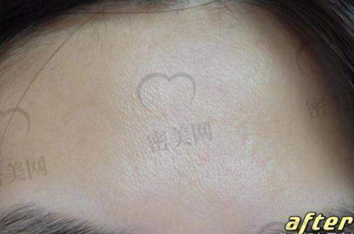 成效能维持多久？
