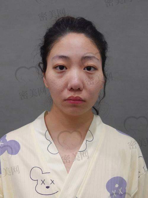 上海伯思立刘李娜：开启你的容貌逆袭之旅