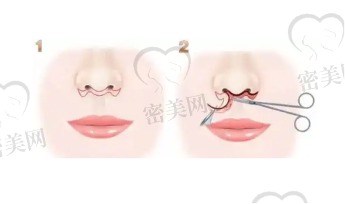 成都疤研疤痕门诊部电话号码：