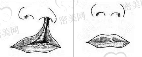成都疤研疤痕门诊部营业时间：