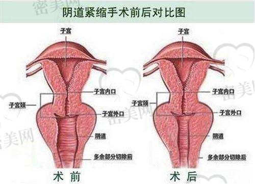 深圳博爱医院整形美容科特色项目：