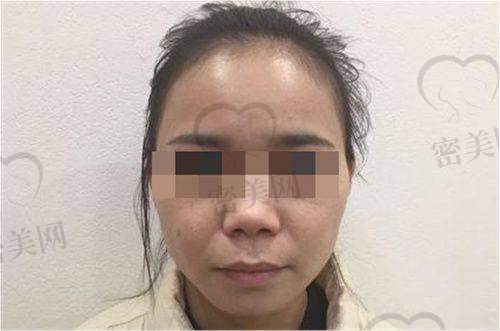 成都疤研疤痕门诊部怎么预约挂号？