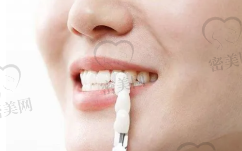 上海维雅口腔门诊部是正规的吗？