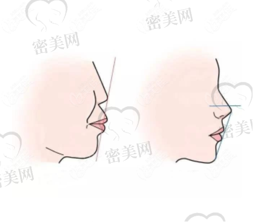 上海泰康拜博万尔口腔门诊部擅长什么项目：