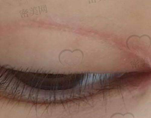 昆山首尔医疗美容医院：韩风技术输出地，提升抗衰细节控