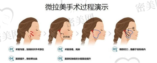 昆山星范医疗美容医院：注重美学设计，整体面部精细化雕刻之选