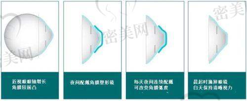 昆明康特森眼科医院全套进口设备，检测+手术更专精