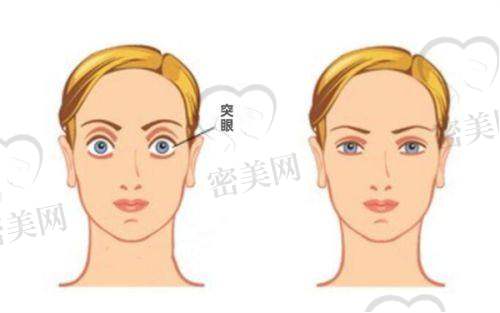 昆明康特森眼科医院近视矫正量多口碑好，手术方式全