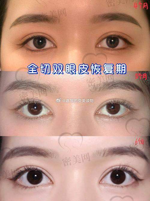 魏志香医生：双眼皮技术的“魔法大师”