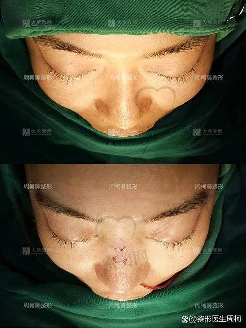 北京沃尔医院：7 万起赵丹鼻修复的强大后盾