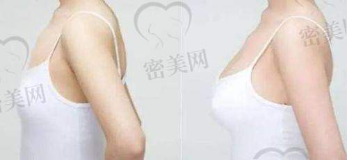 上海艺星陈成隆胸口碑好不好？