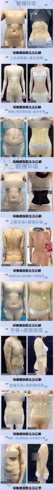 成都蓉美和谐美容医院：专注脂肪类项目，小而美代表