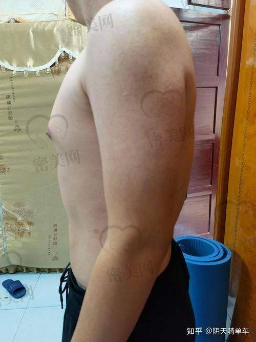 杭州维多利亚整形美容医院：全周期术后管理