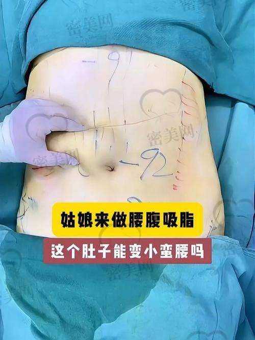 修复过程：一天比一天惊喜