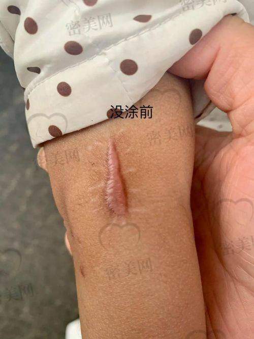 北京广济医院：疤痕治疗的“梦幻城堡”