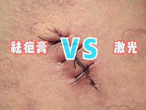 北京广济医院陈业忠：口碑爆棚的疤痕治疗选择