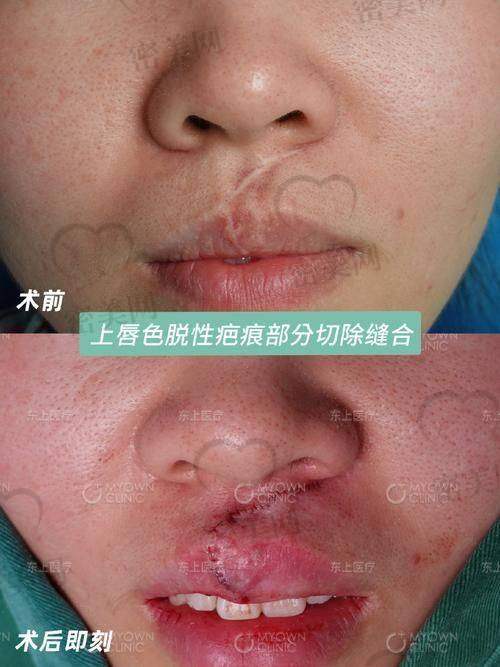 西安高一生：激光仪器配置名列前茅，女性专属护理更贴心