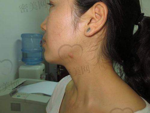 成都疤研疤痕医院的服务体验怎么样？带点“家味”的医疗