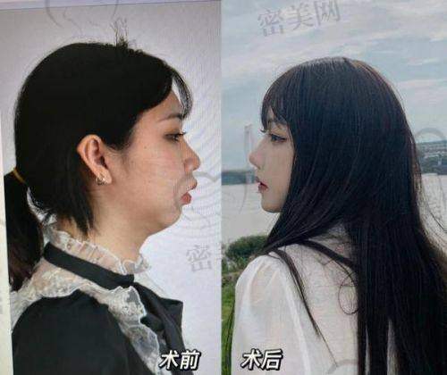 薛芳医生荣誉资质：
