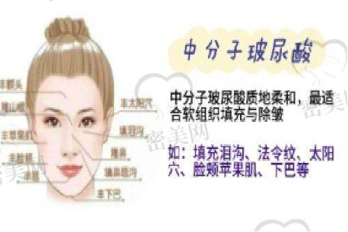 脂肪全脸填充有啥风险和注意事项