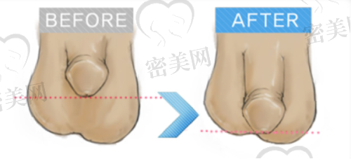 卢飞宇医生擅长项目：
